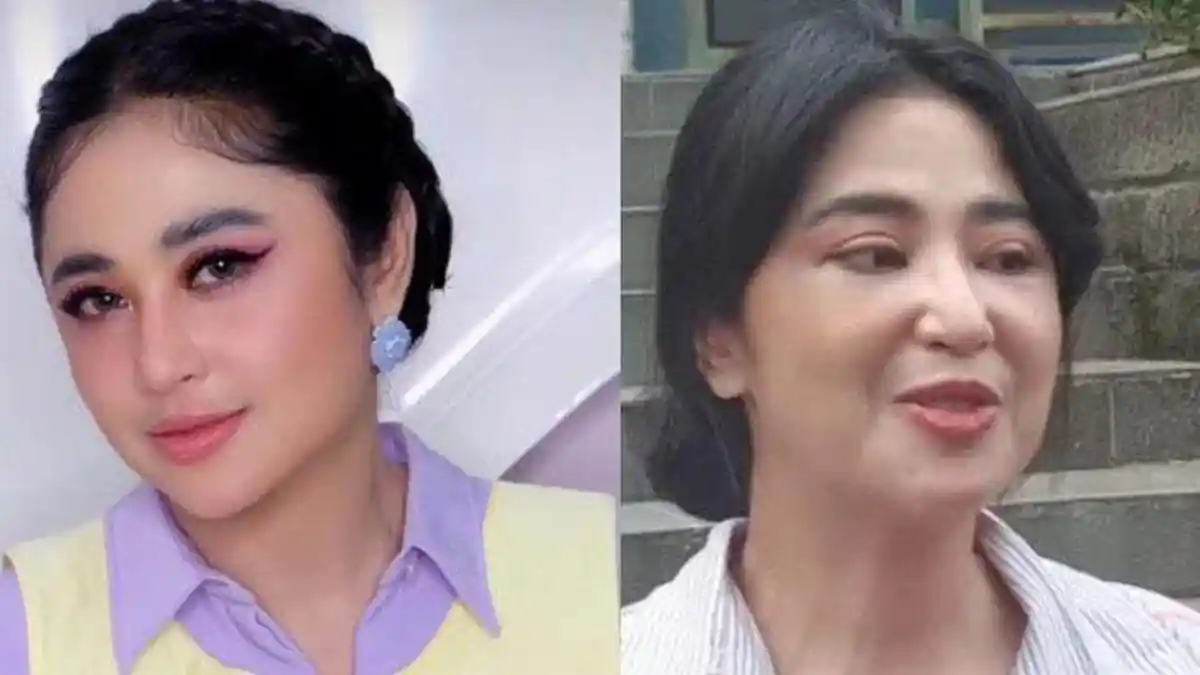 Wajah Barunya Dicibir Lebih Tua, Dewi Perssik: Ini Masih Bengkak