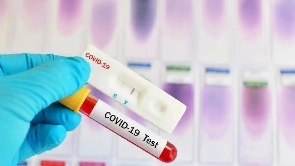 Pemerintah Segera Lakukan Testing dan Tracing Covid-19 Secara Masif