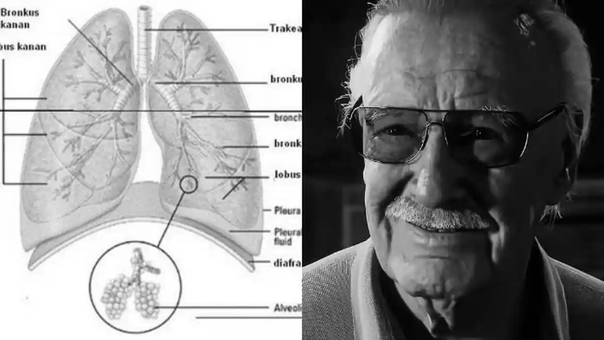Gejala, Penyebab, hingga Orang yang Berpotensi Terjangkit Pneumonia, Penyakit yang Diderita Stan Lee