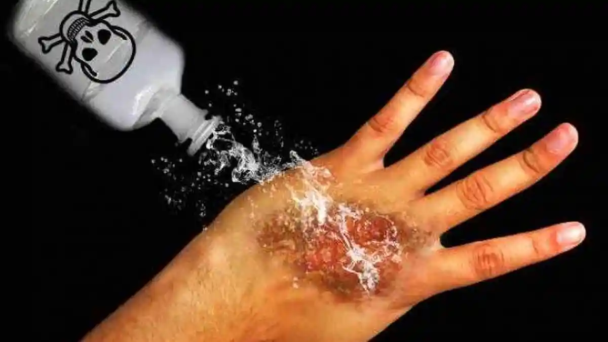 Tak Terima Tongkrongannya Dibubarkan, Anggota Bhabinkamtibmas di Jakarta Disiram Pakai Air Keras