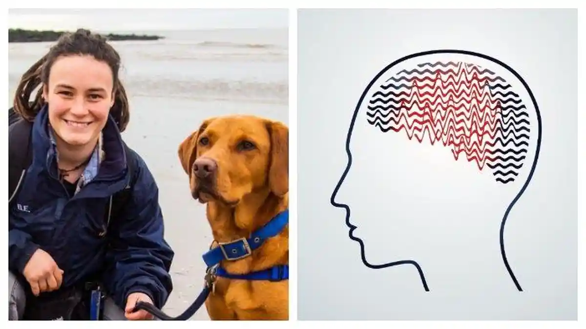 Didiagnosa Terkena Epilepsi sejak Usia 17 Tahun, Wanita Ini Tak Bisa Mandi selama 7 Tahun