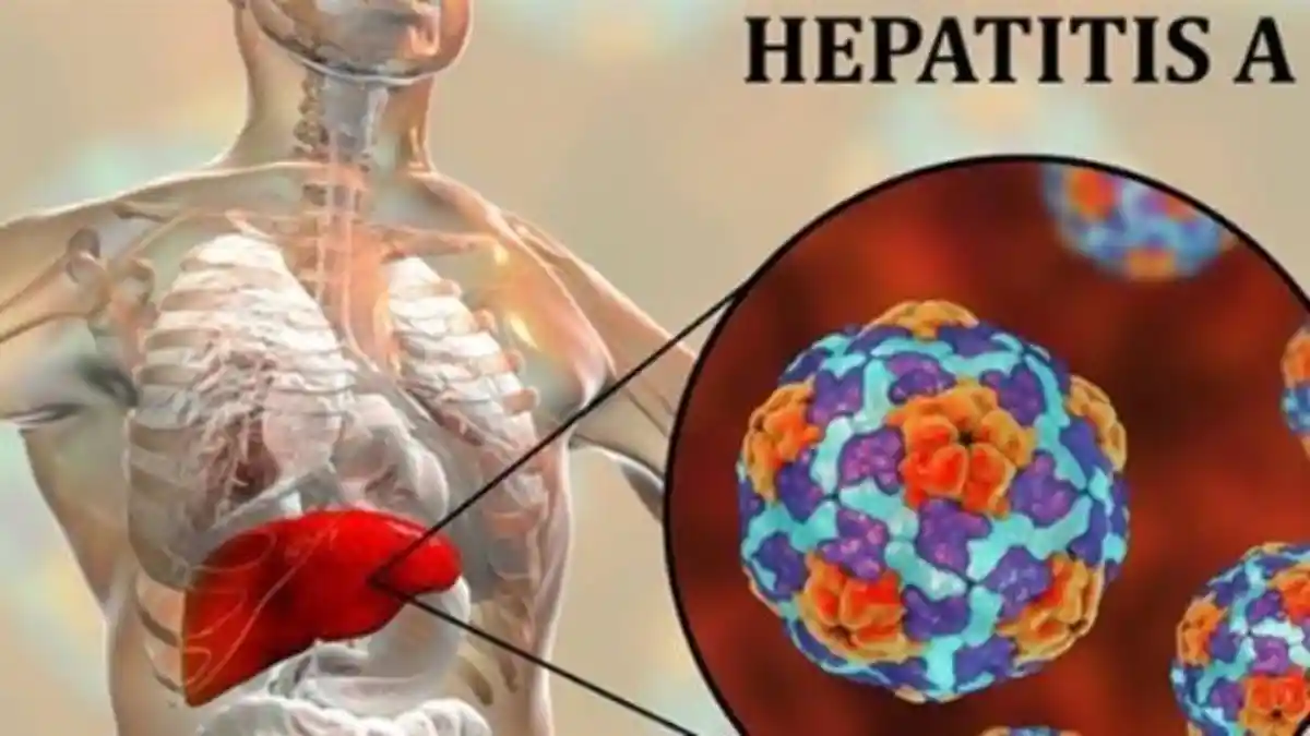 Pencegahan Hepatitis A Melalui Program HEHO Healty Environment Healty Food