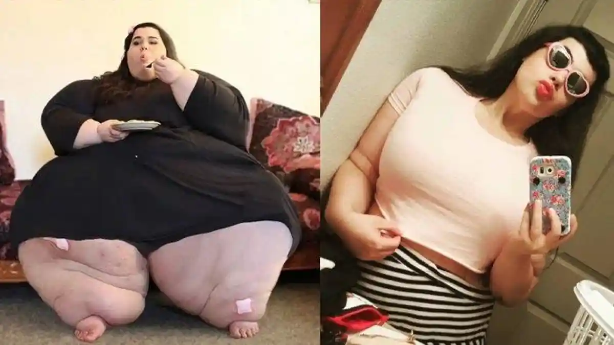 DULU Tubuhnya Gendut Sampai Berbobot 317 Kg, Kini Penampilan Gadis Ini Buat Netizen Pangling