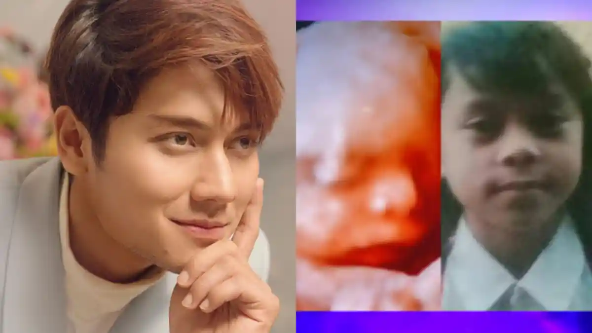 Familiar Hasil USG Anak, Rizky Billar Iseng Sandingkan dengan Foto Lesti saat SD, Syok: Mirip Banget