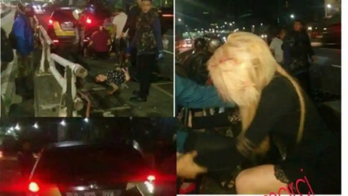 Beredar Foto Kondisi Wajah Sheila Marcia, Netizen: Duh . . . Sampai Nggak Ngenalin