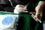 Layanan Transplantasi Rambut