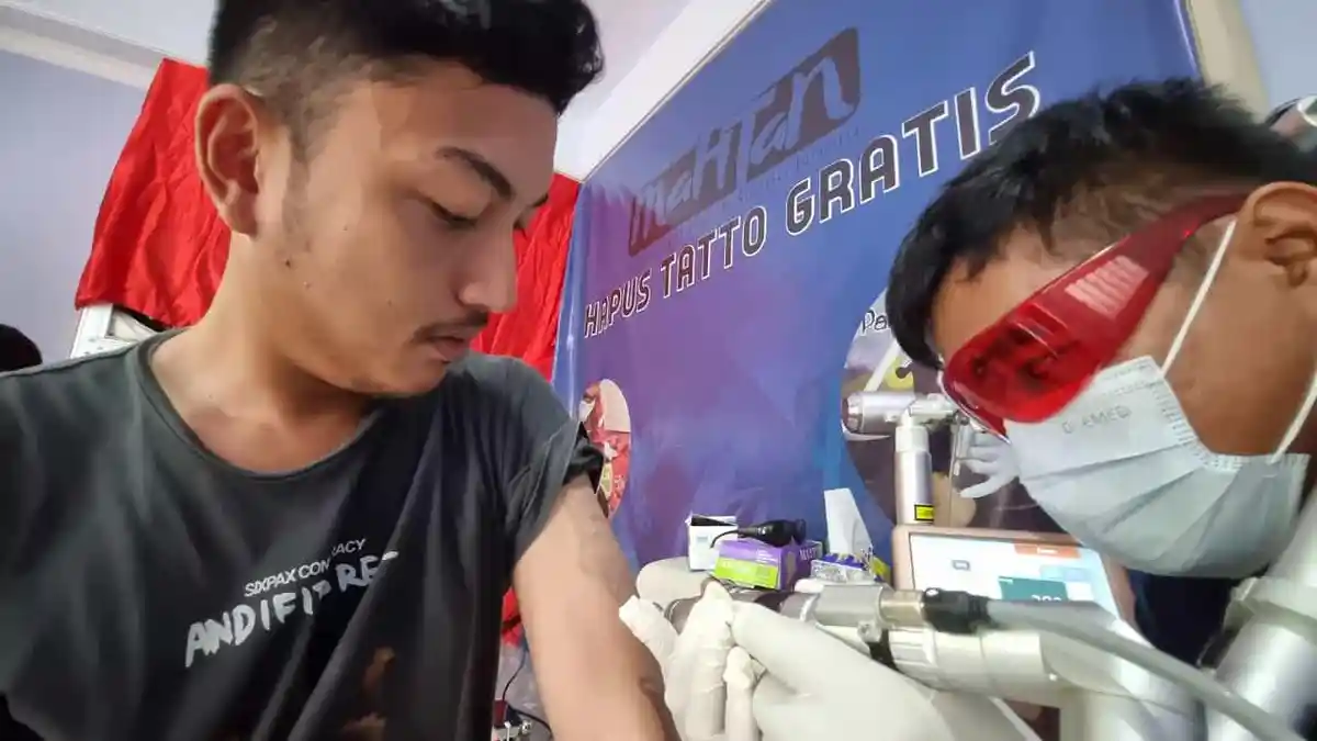 Mesin Laser Yayasan Mahtan Rusak, Ajak Donatur Lanjutkan Program Hapus Tato Gratis