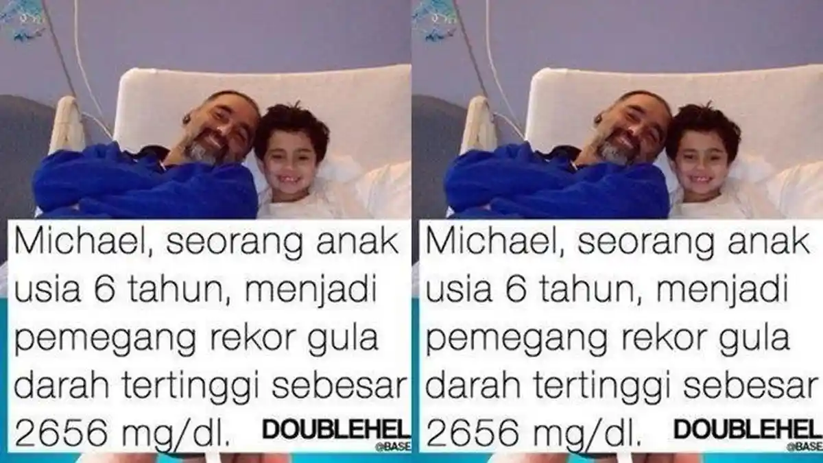Sosok Michael, Bocah dengan Kadar Gula Darah Tertinggi di Dunia saat Usia 6 Tahun, Awalnya Flu