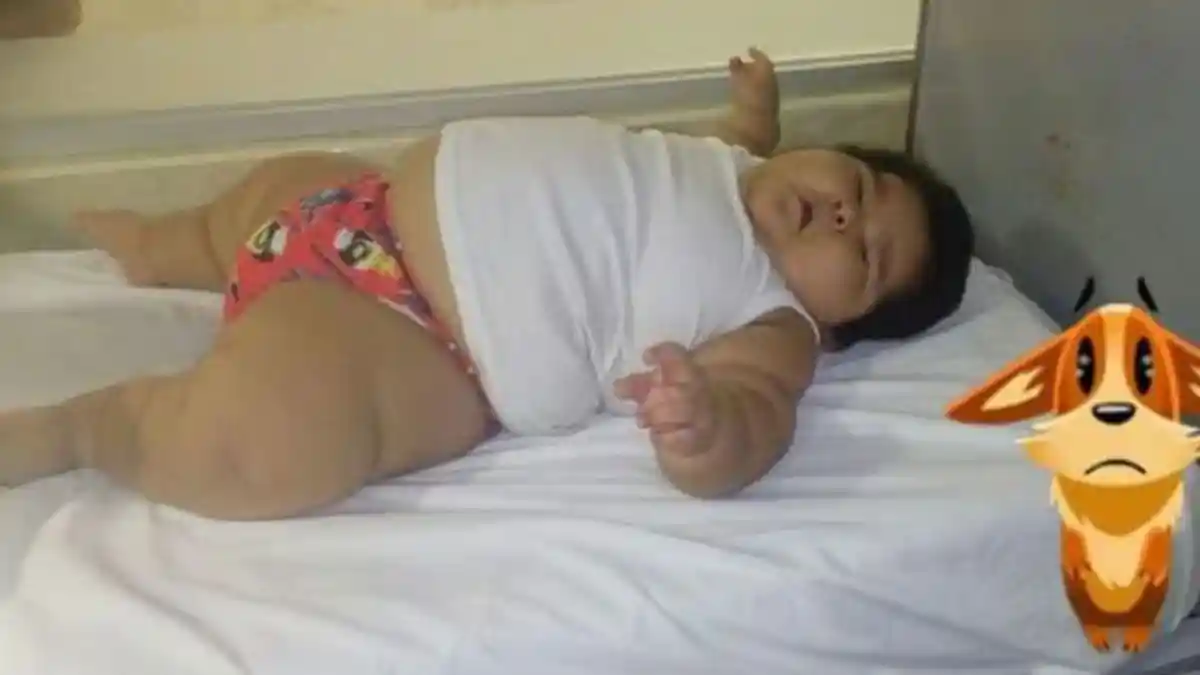 Umurnya Baru 10 Bulan, Bayi Laki-laki Ini Berbobot 30kg