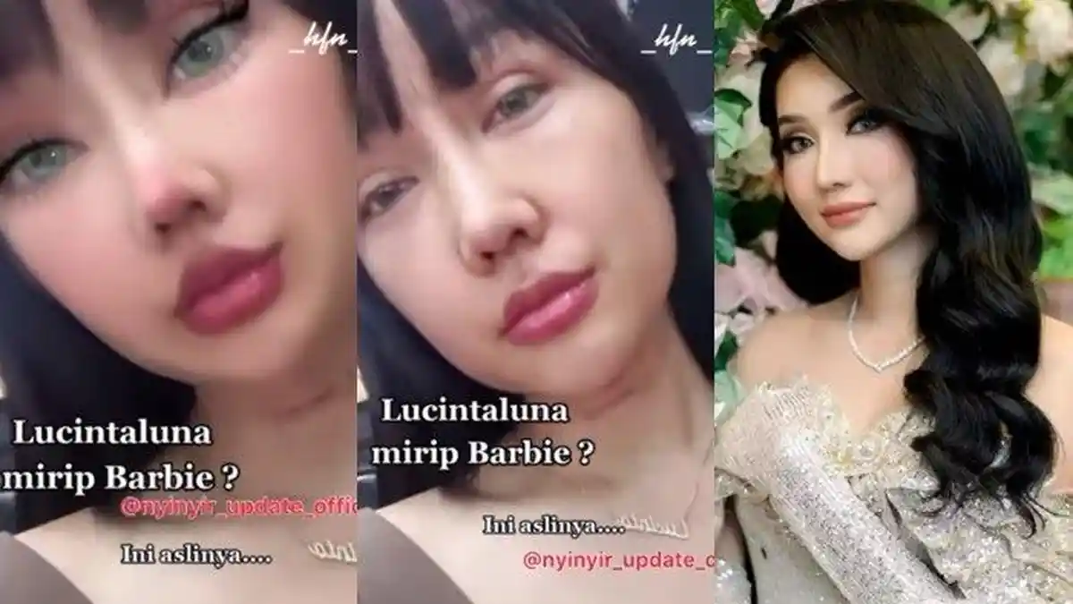Lucinta Luna Mendadak Menangis saat Pamer Suara Baru Pasca Oplas Potong Leher, Kenapa?