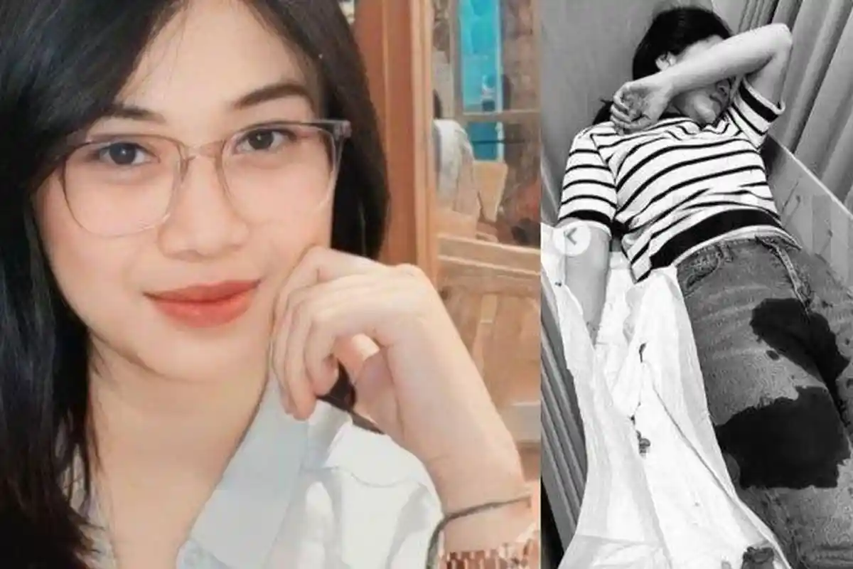 Seorang Wanita Rupawan Dianiaya Mantan Pacar yang Berprofesi Sebagai Anggota Polisi