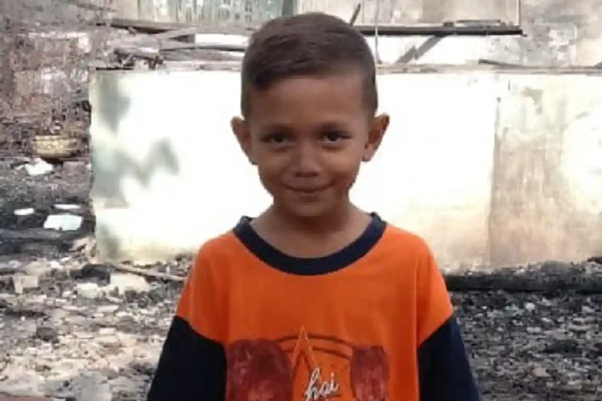 Kisah Pejuangan Bocah 8 Tahun Ini Lolos dari Kobaran Api Bikin Haru, Kaki Terkilir Saat Diselamatkan