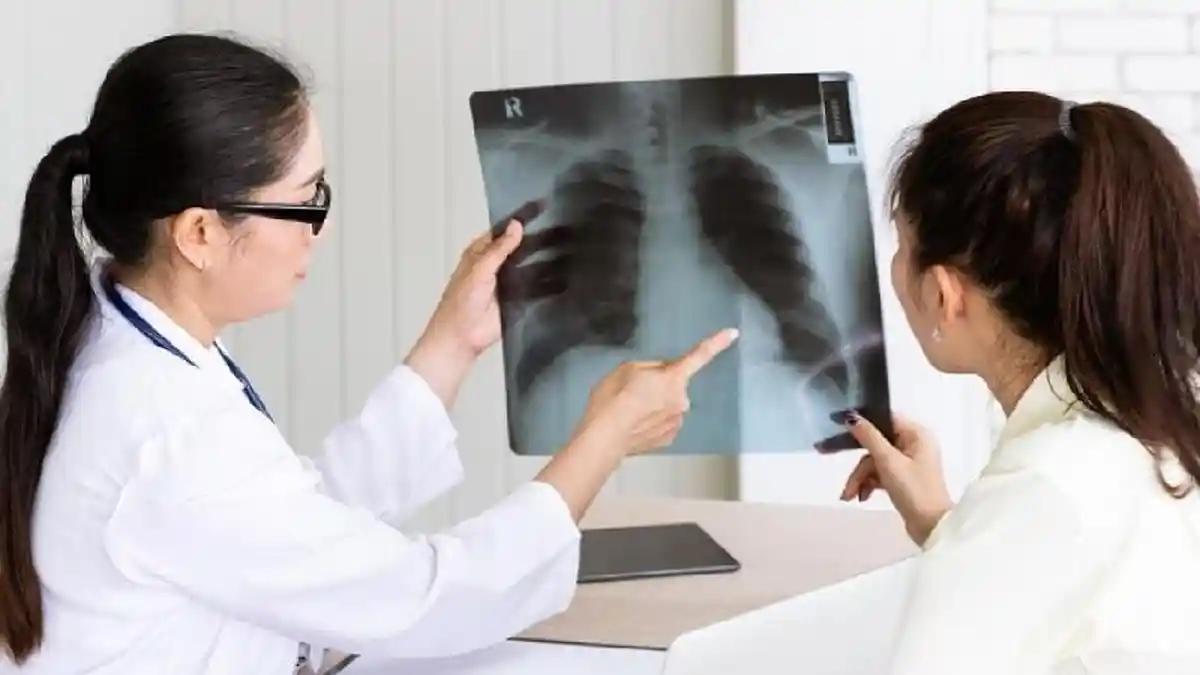 Apa Itu CT Scan Low Dose? Mampu Deteksi Dini Kanker Paru, Radiasi Lebih ...