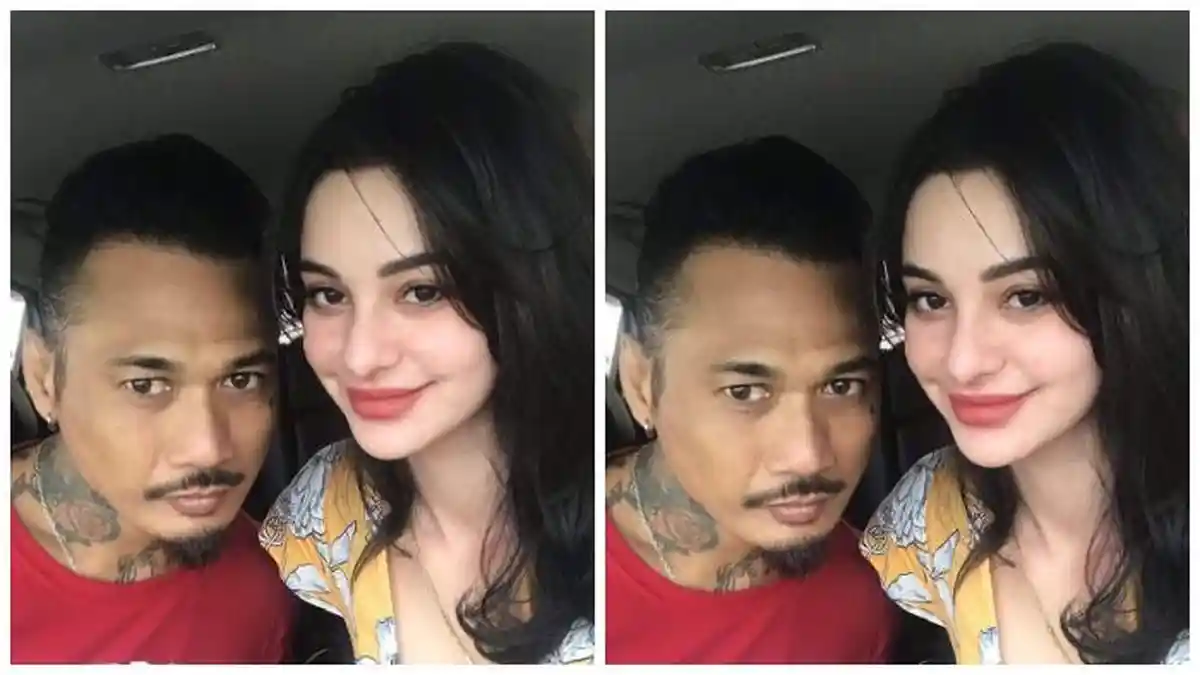 Operasi Sebelum Program Bayi Tabung, Nora Alexandra Tak Temani Jerinx Manggung Bareng SID