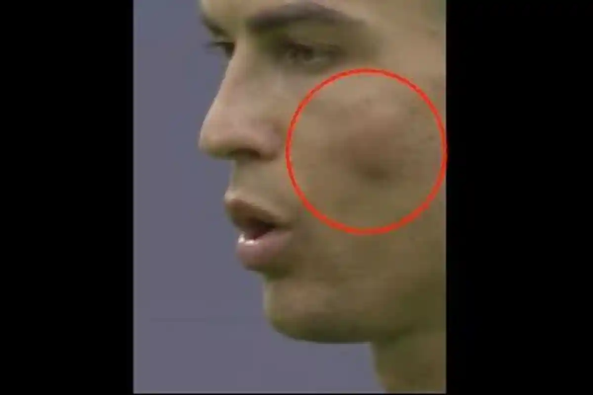 Dapat Hadiah Spesial, Ronaldo Malah Bernasib Apes, CR7 Mandul, Pipi Memar Kena Lutut Pemain Lawan