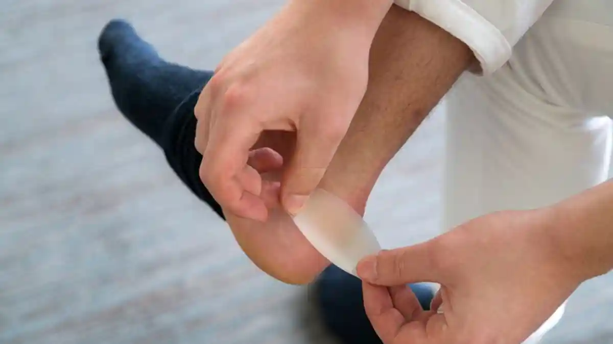 Terganggu karena Luka Lecet di Kaki? Ini Cara Mengatasinya yang Benar