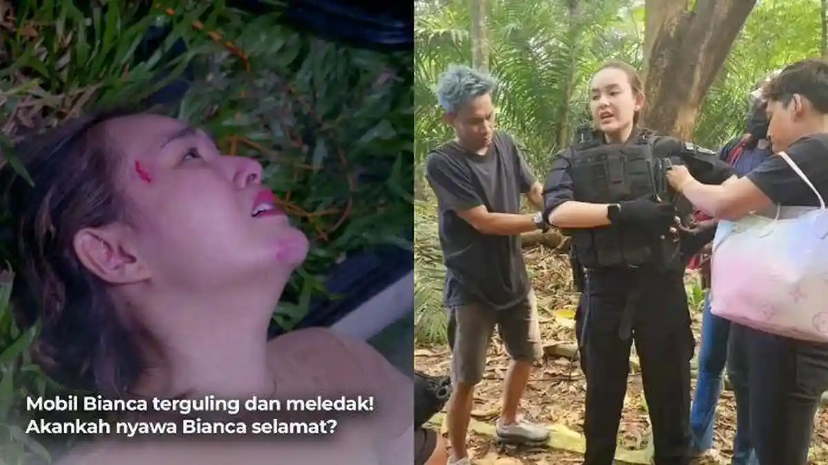 Amanda Manopo Diduga Tetap Bintangi Sinetron Cinta Tanpa Karena usai Alami Kecelakaan