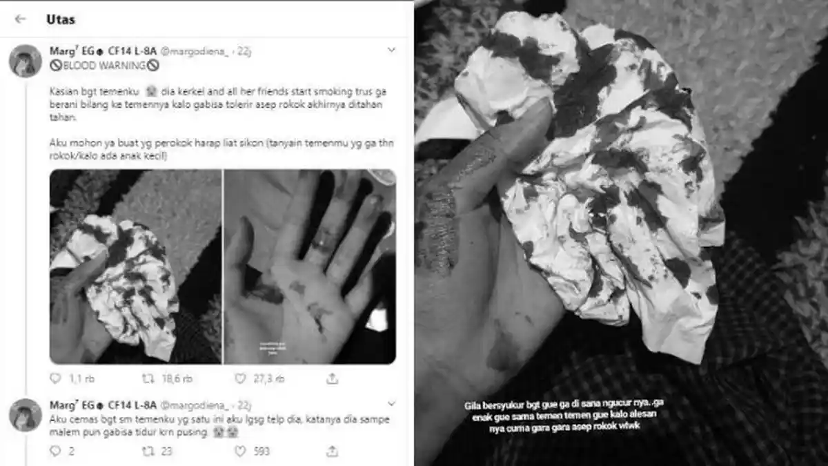 VIRAL Seorang Perempuan Mimisan Akibat Terpapar Asap Rokok, Begini Penjelasan Dokter
