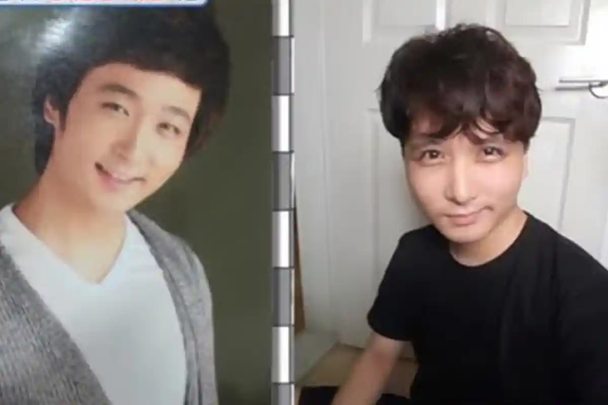 Ingin Jadi Aktor, Hidup Pria ini Justru Berantakan Karena Oplas, Lihat Perubahan Wajahnya!