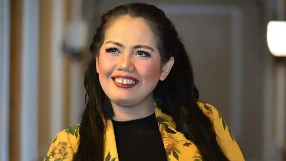 Perubahan Drastis Elly Sugigi Setelah Wajahnya Dipermak Cantik Banget, Pantas Bule Australia Nempel