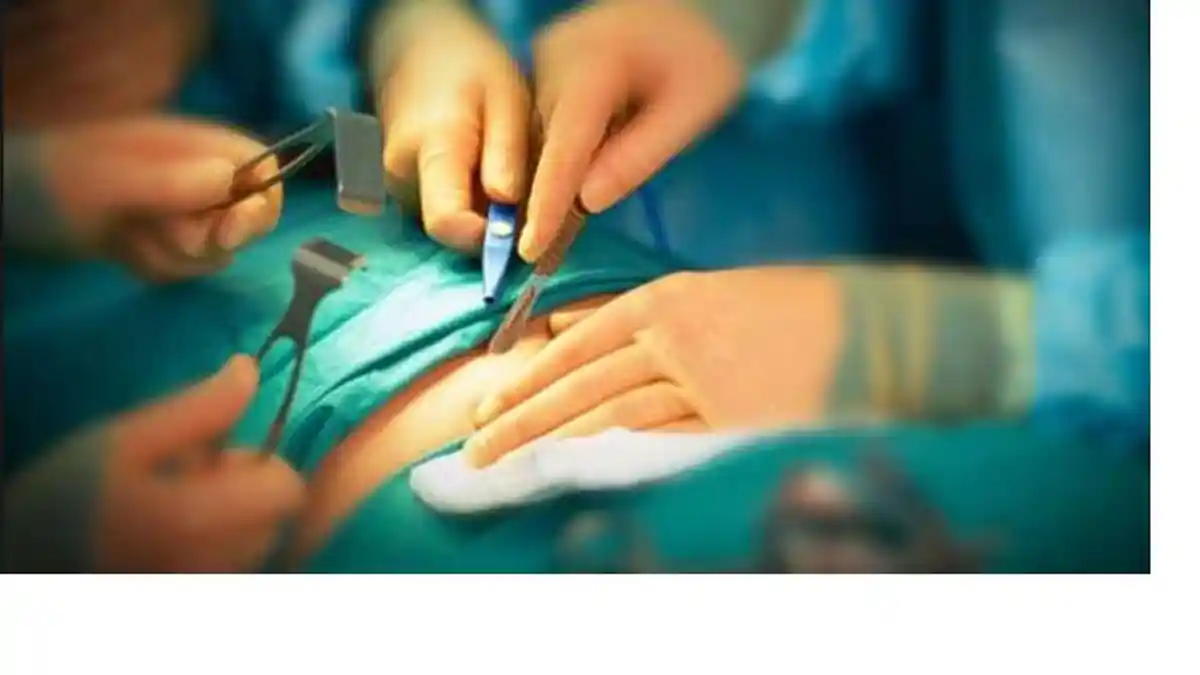 Astaga! Operasi Bedah Bukannya Potong Kista, Tapi Testis, Bukan Angkat Kandungan Tapi Ginjal