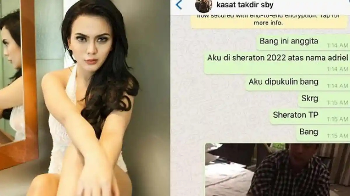 Anggita Sari Ngaku Dipukuli di Dalam Kamar Hotel, Ini Selanjutnya