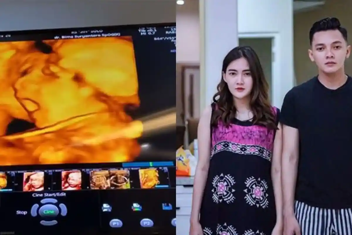 Suami Nella Kharisma Unggah Video USG, Pose Calon Anak Dory Harsa yang Lagi 'Nguap' Curi Perhatian