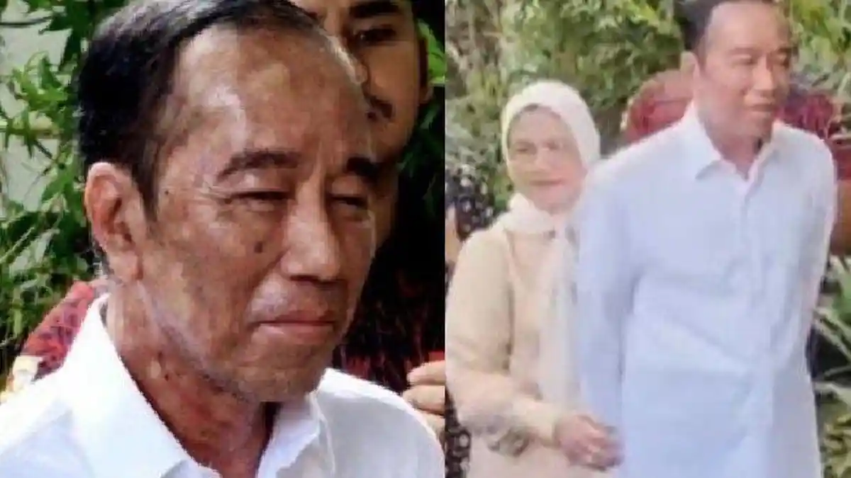 JOKOWI Kritis hingga Dilarikan ke RS? Kondisi Alergi Kulitnya Terkini Diungkap Sang Ajudan
