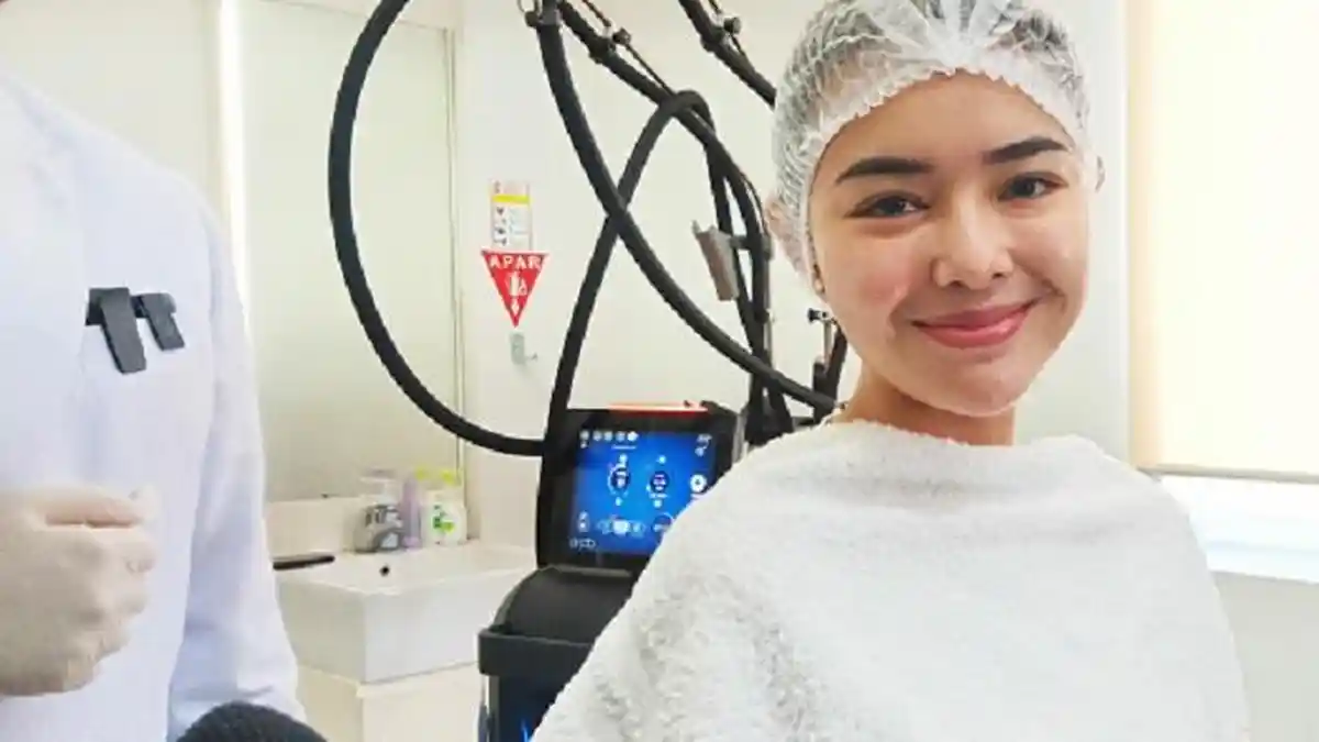 Wajah Amanda Manopo Memburuk Seperti Kena Cacar, Ternyata Ini Penyebabnya