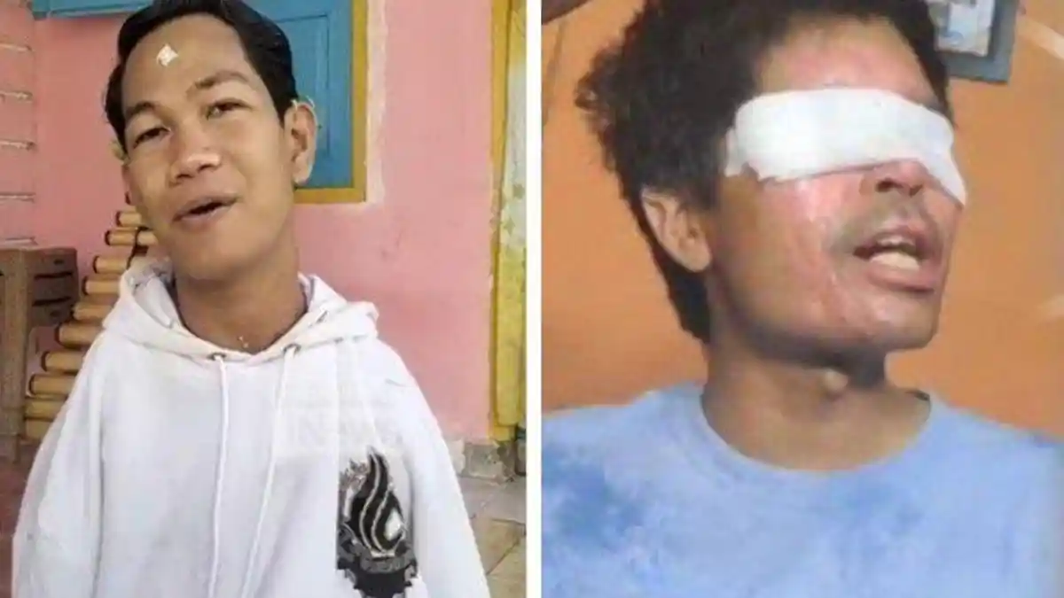 Nama Agus Menjadi Topik Viral, Kasus Agus Salim dengan Agus Buntung yang Tengah Disorot Publik