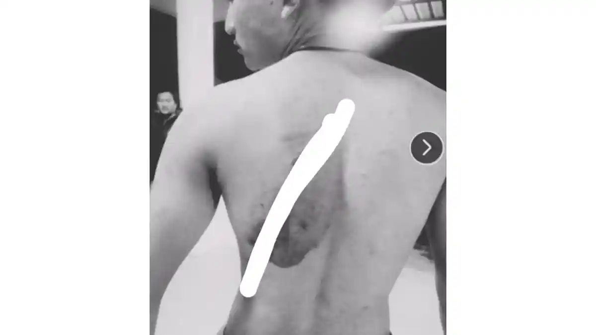 Puluhan Orang Serang Kafe di Sampali, Lima Luka Berat, Dua Pelaku Diamankan