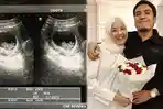 Desta Unggah Foto USG Istri, Komentar Netizen Bikin Ngakak 'Hasil Nyungsep di TV', Apa Hubungannya?