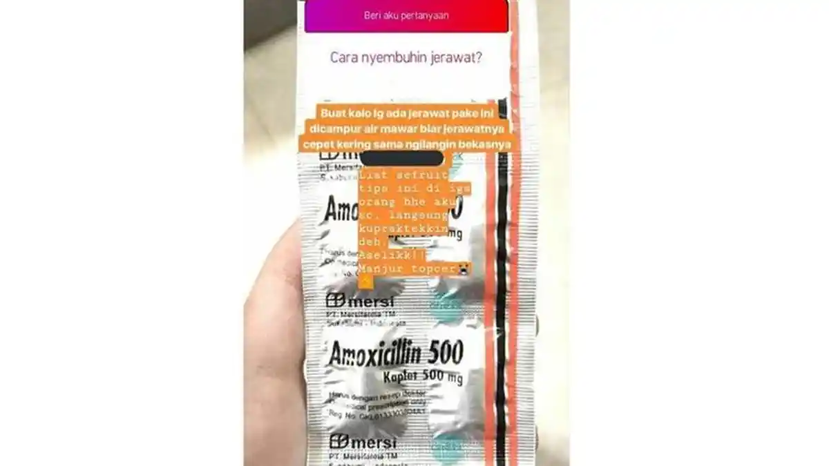 BERITA KESEHATAN - Viral Postingan Antibiotik Dijadikan Obat Jerawat, Ini Penjelasan Dokter!