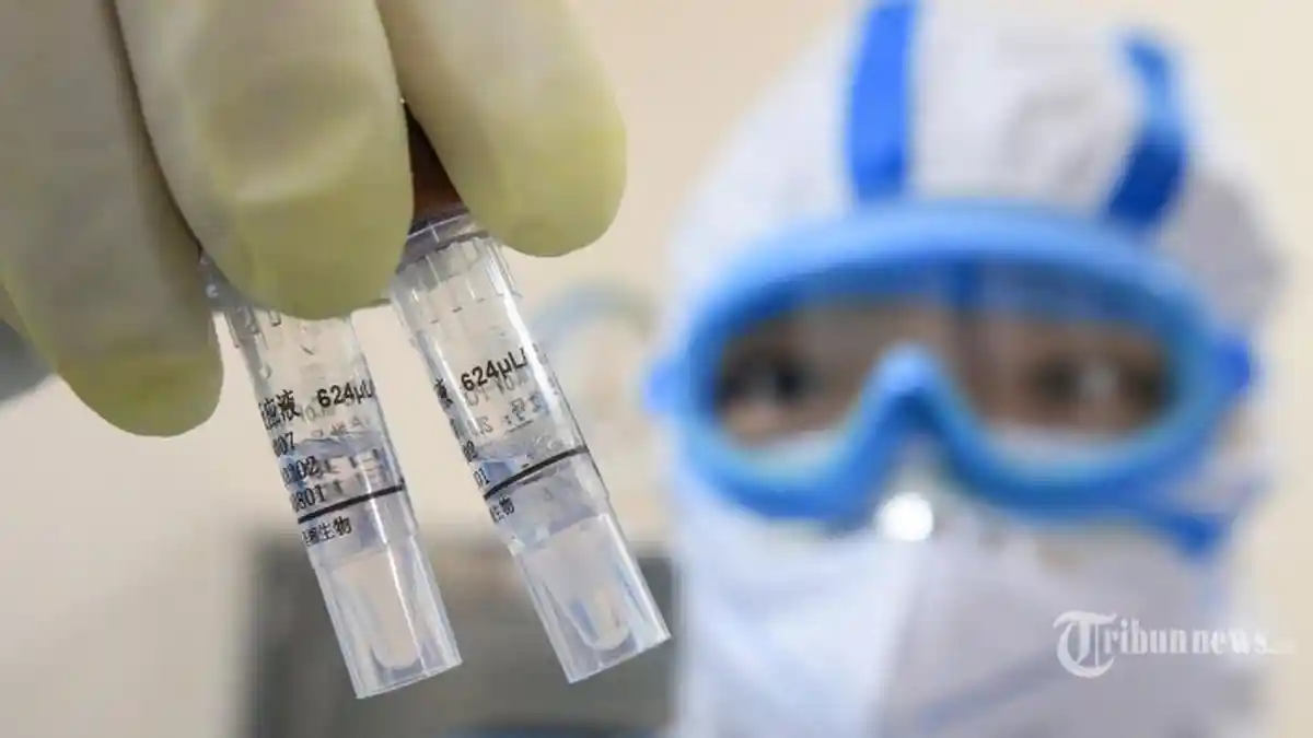 Obat Antimalaria ini Dinilai Efektif Atasi Virus Corona, Waktu Pemulihannya Lebih Cepat!