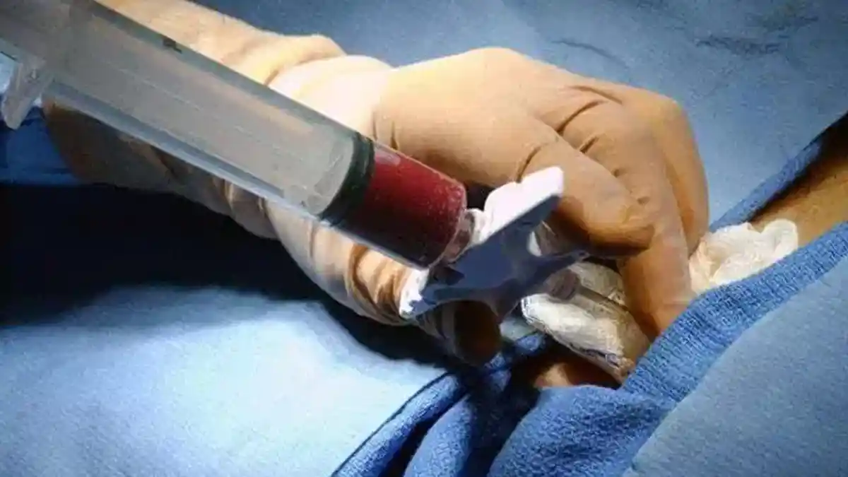 Ini Harga 7 Organ Tubuh di Black Market, No. 5 Paling Ngeri, tapi Paling Gampang Hasilkan Duit!