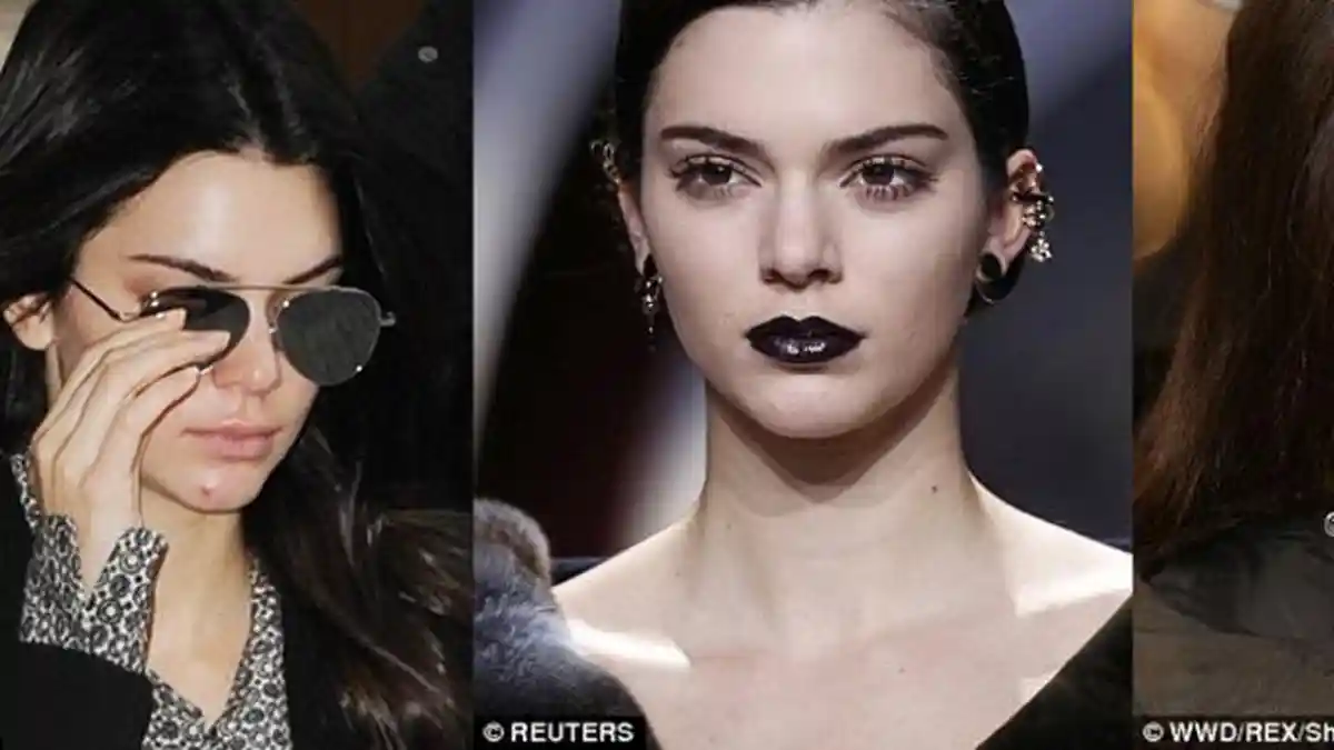 Cara Ajaib Supermodel Kendall Jenner Hilangkan Jerawat 'Menor' dalam Semalam