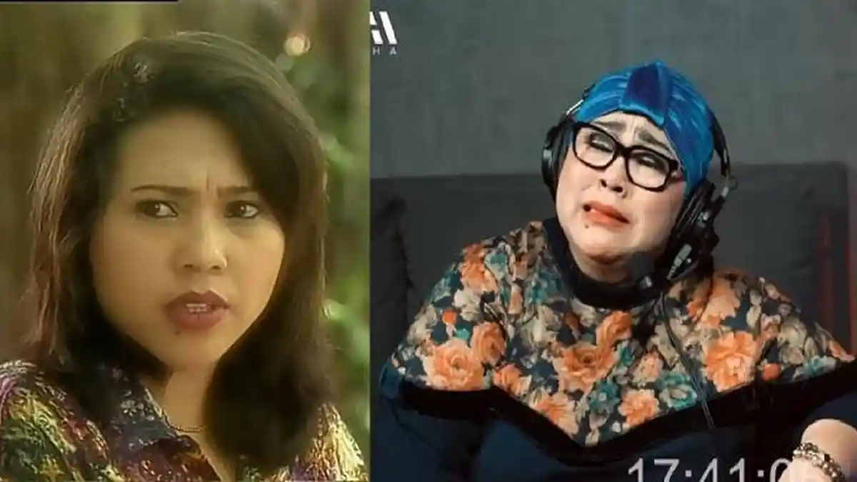 Nunung Masih Simpan Rambutnya Meski Botak Setelah Kemoterapi, Tangis Pecah saat Ceritakan Rasa Sakit