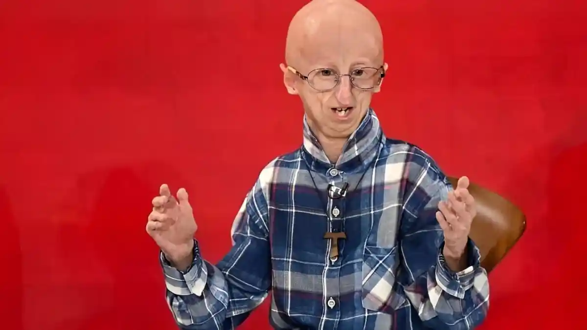 Sosok Sammy Basso, Penyintas Penyakit Langka Progeria Meninggal Dunia pada Usia 28 Tahun