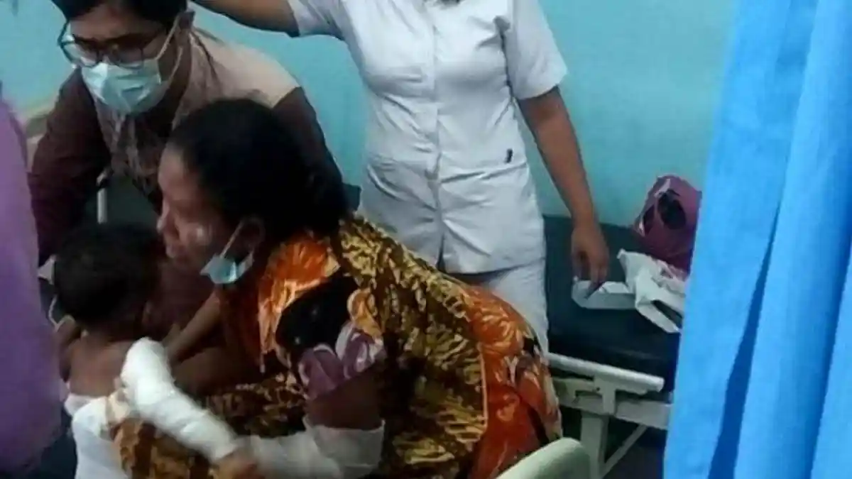Uap Bensin Tersulut Api dari Kompor, Satu Keluarga di Deliserdang Celaka, Japar Luka 70 Persen