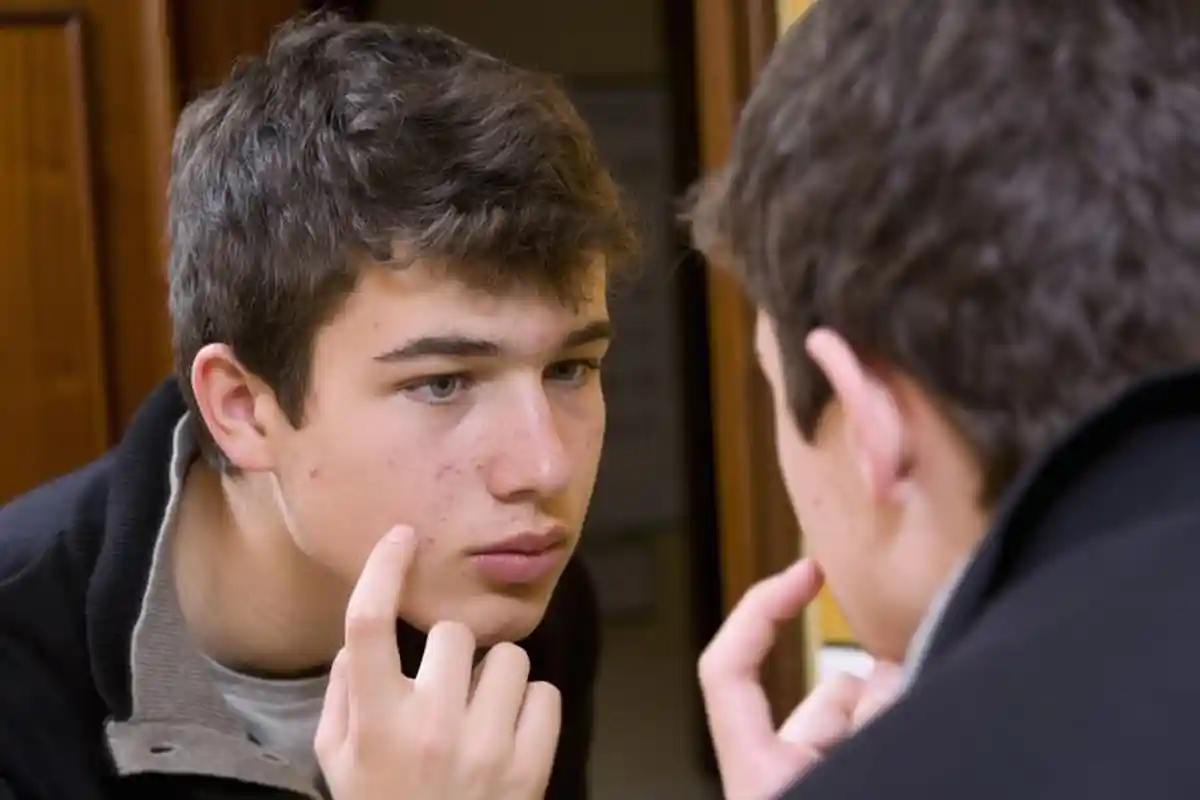 Ampuh Cegah Jerawat, Inilah 7 Makanan yang Wajib Dikonsumsi Agar Wajahmu Mulus!