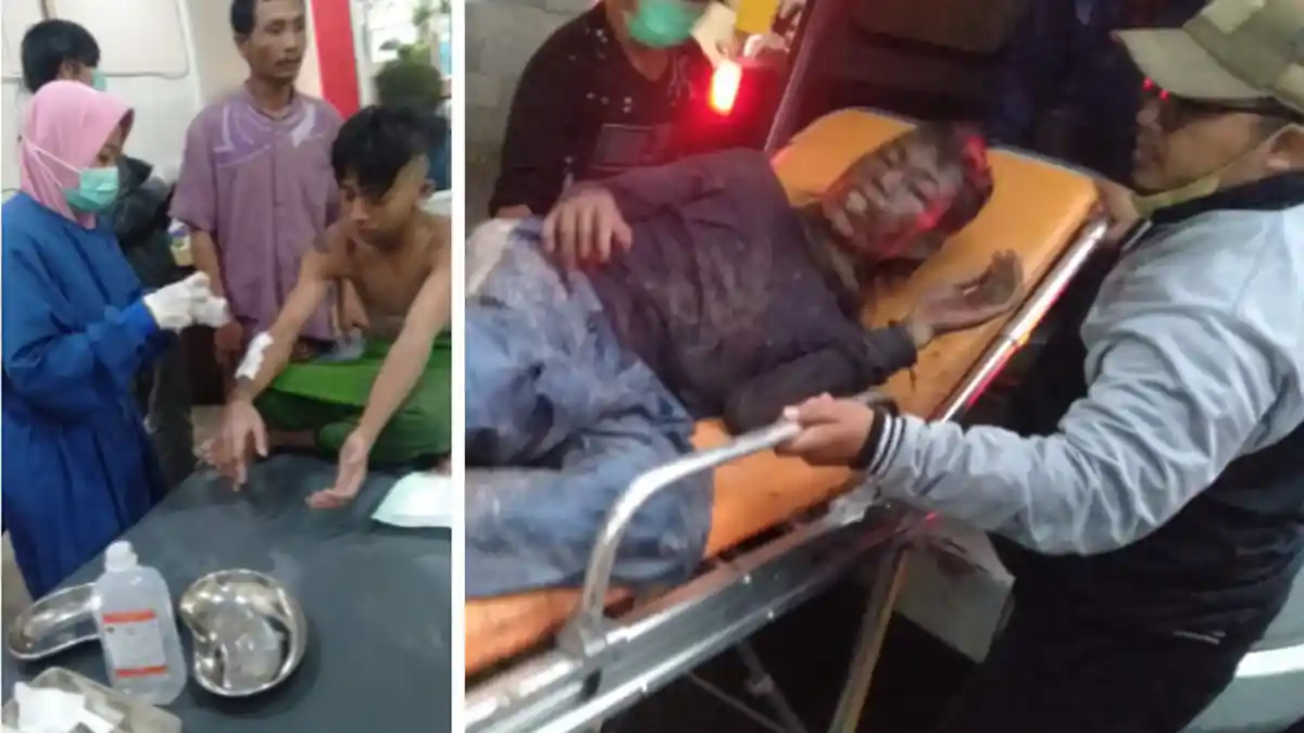 Perapi Kirim Dokter Spesialis Bedah Plastik dari Malang ke Lumajang Demi Bantu Korban Luka Bakar