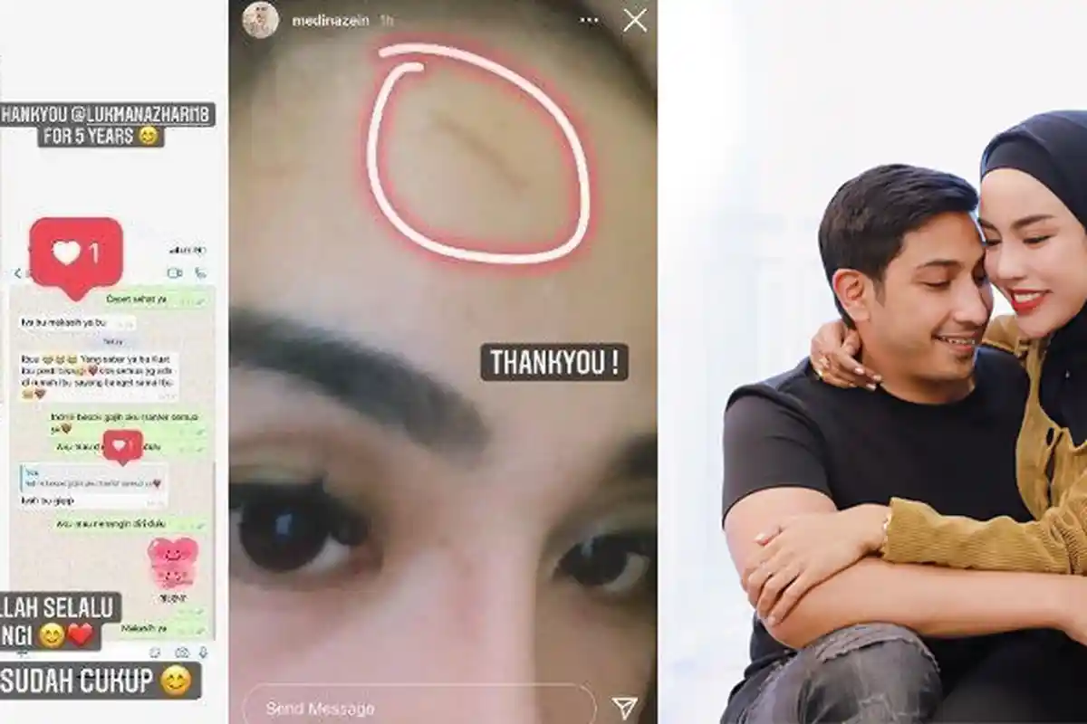 'Sudah Cukup', Pilu Medina Zein Jadi Korban KDRT, Tubuh Penuh Lebam Tangan Lecet: Sabar Ada Batasnya