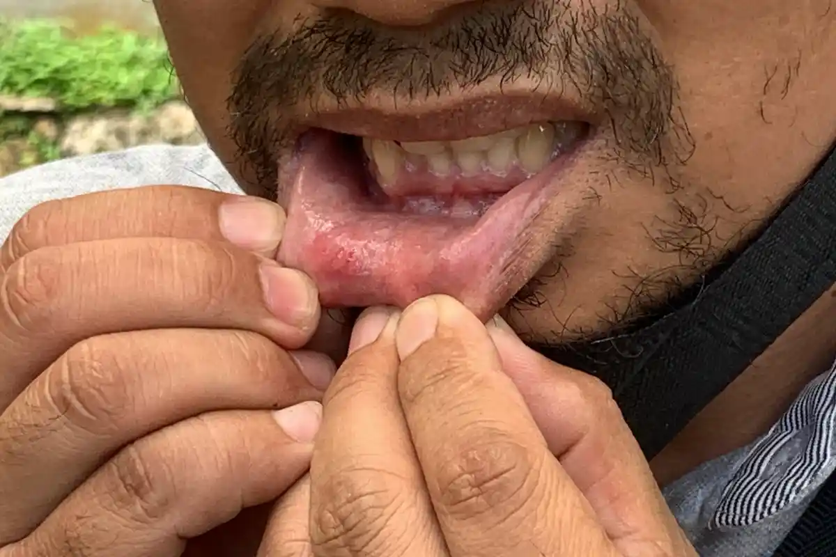 BREAKING NEWS, Driver Ojol Lapor Polisi Dipukul Oknum Sopir Taksi Bandara Tjilik Riwut