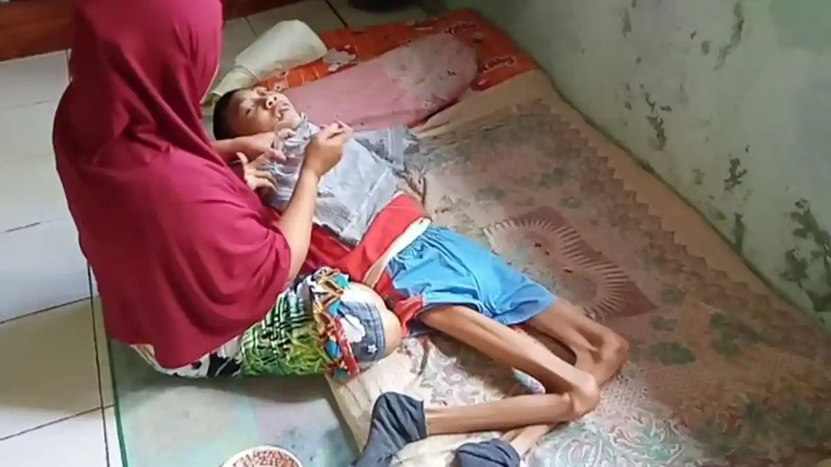 Kisah Samini, Rawat Anak Usia 19 Tahun yang Alami Kelainan dan Suami yang Harus Cuci Darah
