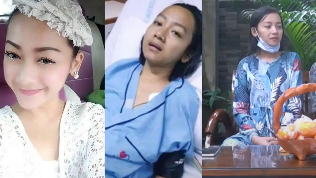 Cerita Pedangdut Elyn Munchen Stroke Mendadak Usai Manggung, Sempat Lumpuh, Kini Mulai Pulih & Hamil