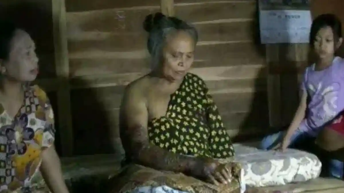 Nenek 70 Tahun Selamat dari Maut setelah Digigit Ular, Tangannya Melepuh dan Sempat Muntah Darah