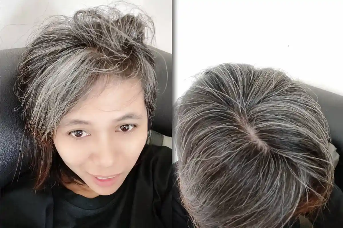 Stres hingga Rokok, Ini Penyebab Rambut Beruban di Usia Muda hingga Pencegahannya!