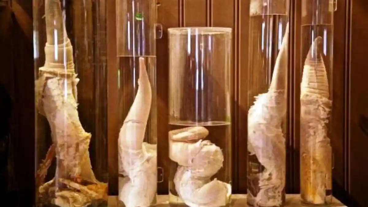 Bergidik dan Menyeramkan, Parade Alat Kelamin Pria Terpajang di Museum Ini