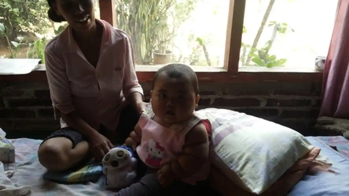 Ada Bayi Enam Bulan Bobotnya 16,5 Kg