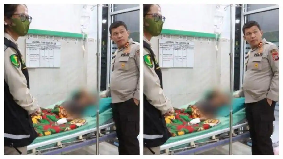 Perut dan Punggung Disetrika Tante, Bocah di Simalungun Alami Luka Bakar 30 Persen 